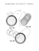 FLUID COLLECTION RESERVOIR AND ANTI-SPILL MECHANISM diagram and image