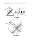 SYSTEM AND METHOD FOR EVALUATING SURGICAL KNOT FORMATION diagram and image