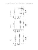 BIOMARKERS FOR DISTINGUISHING BETWEEN AGGRESSIVE PROSTATE CANCER AND     NON-AGGRESSIVE PROSTATE CANCER diagram and image