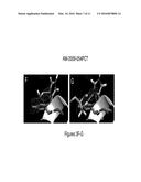 METHOD FOR BINDING SITE IDENTIFICATION BY MOLECULAR DYNAMICS SIMULATION     (SILCS: SITE IDENTIFICATION BY LIGAND COMPETITIVE SATURATION) diagram and image