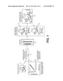 METHOD AND SYSTEM FOR QUANTIFYING LIMITATIONS IN CORONARY ARTERY BLOOD     FLOW DURING PHYSICAL ACTIVITY IN PATIENTS WITH CORONARY ARTERY DISEASE diagram and image