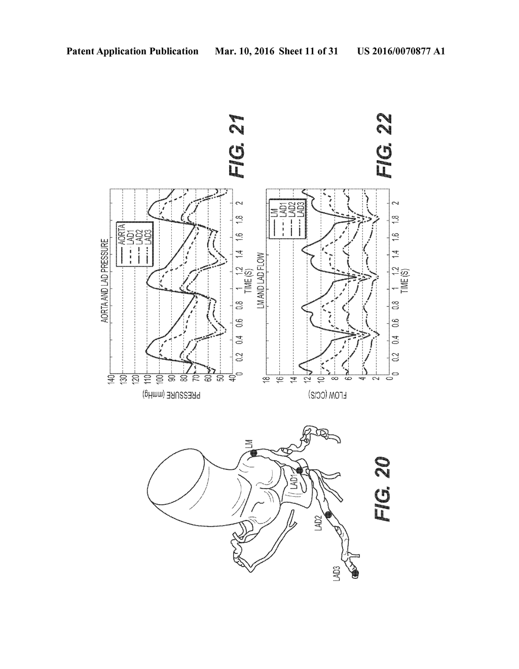 METHOD AND SYSTEM FOR QUANTIFYING LIMITATIONS IN CORONARY ARTERY BLOOD     FLOW DURING PHYSICAL ACTIVITY IN PATIENTS WITH CORONARY ARTERY DISEASE - diagram, schematic, and image 12