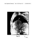 POLAR MAGNETIC RESONANCE IMAGING AND APPLICATIONS THEREOF IN CARDIAC     MAGNETIC RESONANCE IMAGING diagram and image