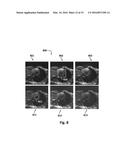 POLAR MAGNETIC RESONANCE IMAGING AND APPLICATIONS THEREOF IN CARDIAC     MAGNETIC RESONANCE IMAGING diagram and image