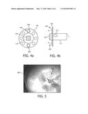 IMAGING A PATIENT S INTERIOR diagram and image