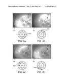 IMAGING A PATIENT S INTERIOR diagram and image