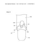 HOOD FOR ULTRASONIC ENDOSCOPE AND ULTRASONIC ENDOSCOPE diagram and image