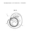 PACKAGING MATERIAL FOR ENDOSCOPIC TREATMENT SYSTEM AND ENDOSCOPE SYSTEM diagram and image