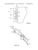 IMPLANTABLE DIELECTROMETER diagram and image