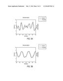 METHODS AND SYSTEMS FOR RAPID SCREENING OF MILD TRAUMATIC BRAIN INJURY diagram and image