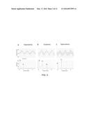 HYPOVOLEMIA/HYPERVOLEMIA DETECTION USING PERIPHERAL INTRAVENOUS WAVEFORM     ANALYSIS (PIVA) AND APPLICATIONS OF SAME diagram and image