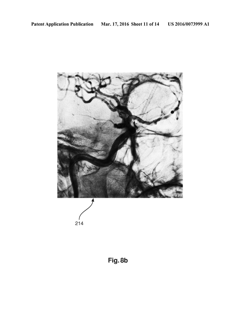 X-RAY BEAM SHAPING - diagram, schematic, and image 12