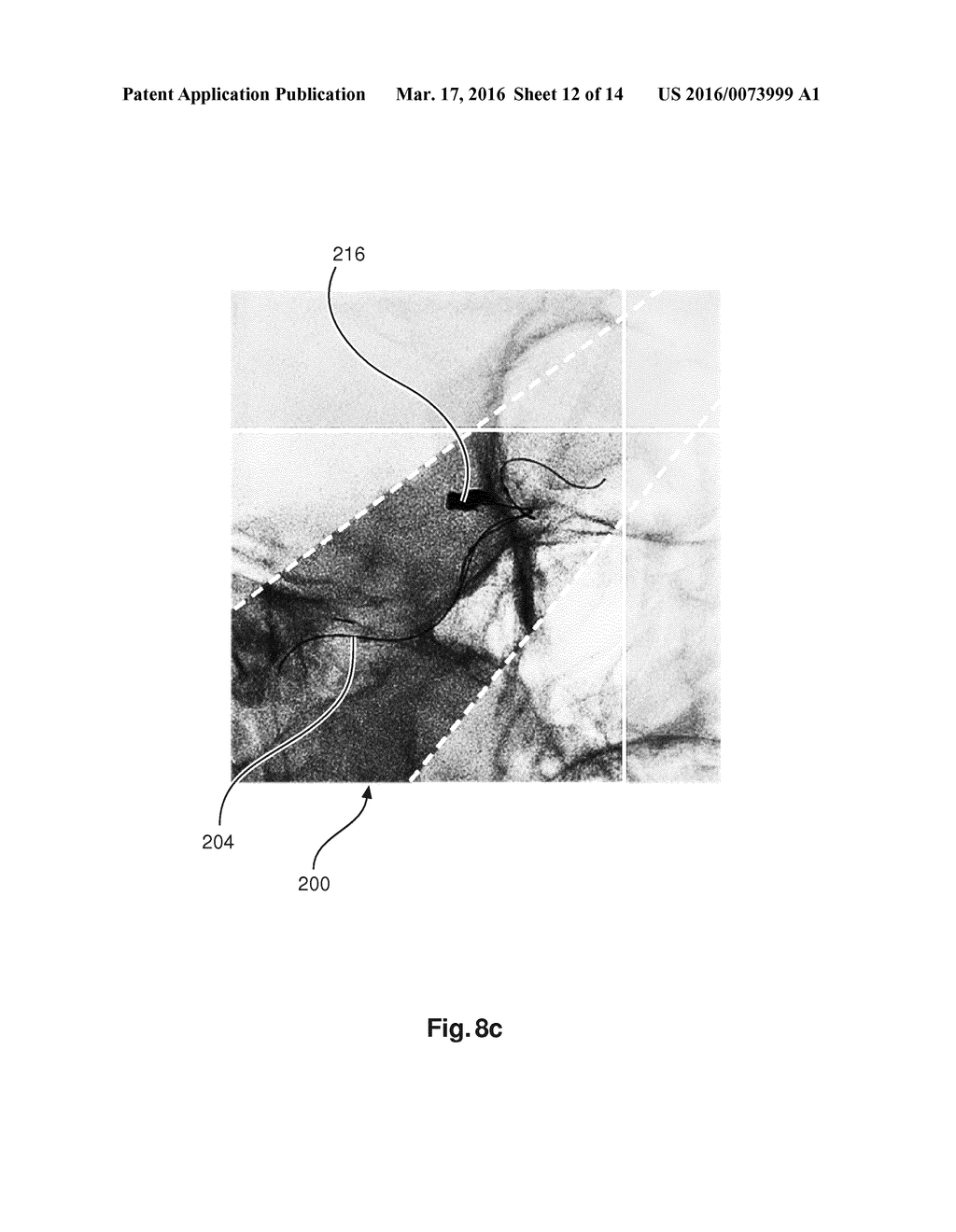 X-RAY BEAM SHAPING - diagram, schematic, and image 13