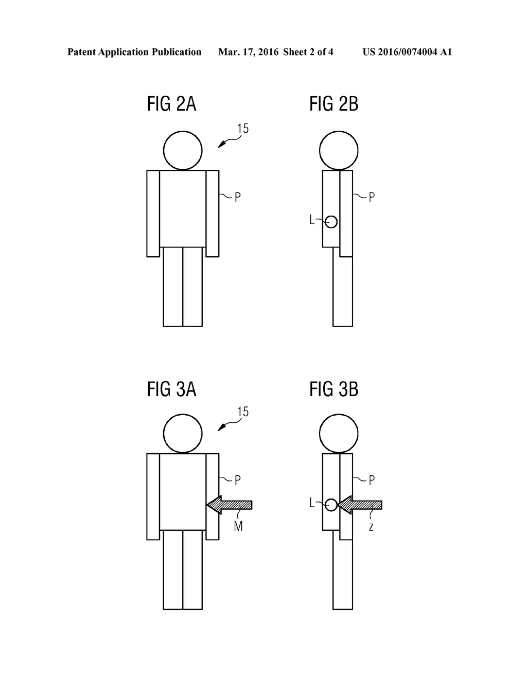 POSITIONING OF AN EXAMINATION TABLE RELATIVE TO A MEDICAL IMAGING     APPARATUS - diagram, schematic, and image 03