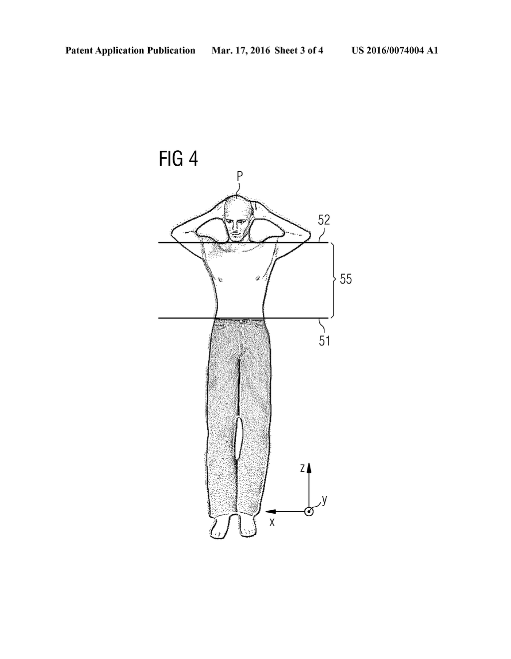 POSITIONING OF AN EXAMINATION TABLE RELATIVE TO A MEDICAL IMAGING     APPARATUS - diagram, schematic, and image 04