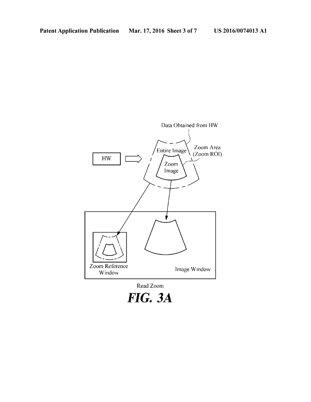 IMAGE ENLARGEMENT METHOD AND ULTRASOUND MEDICAL DEVICE FOR SAME - diagram, schematic, and image 04