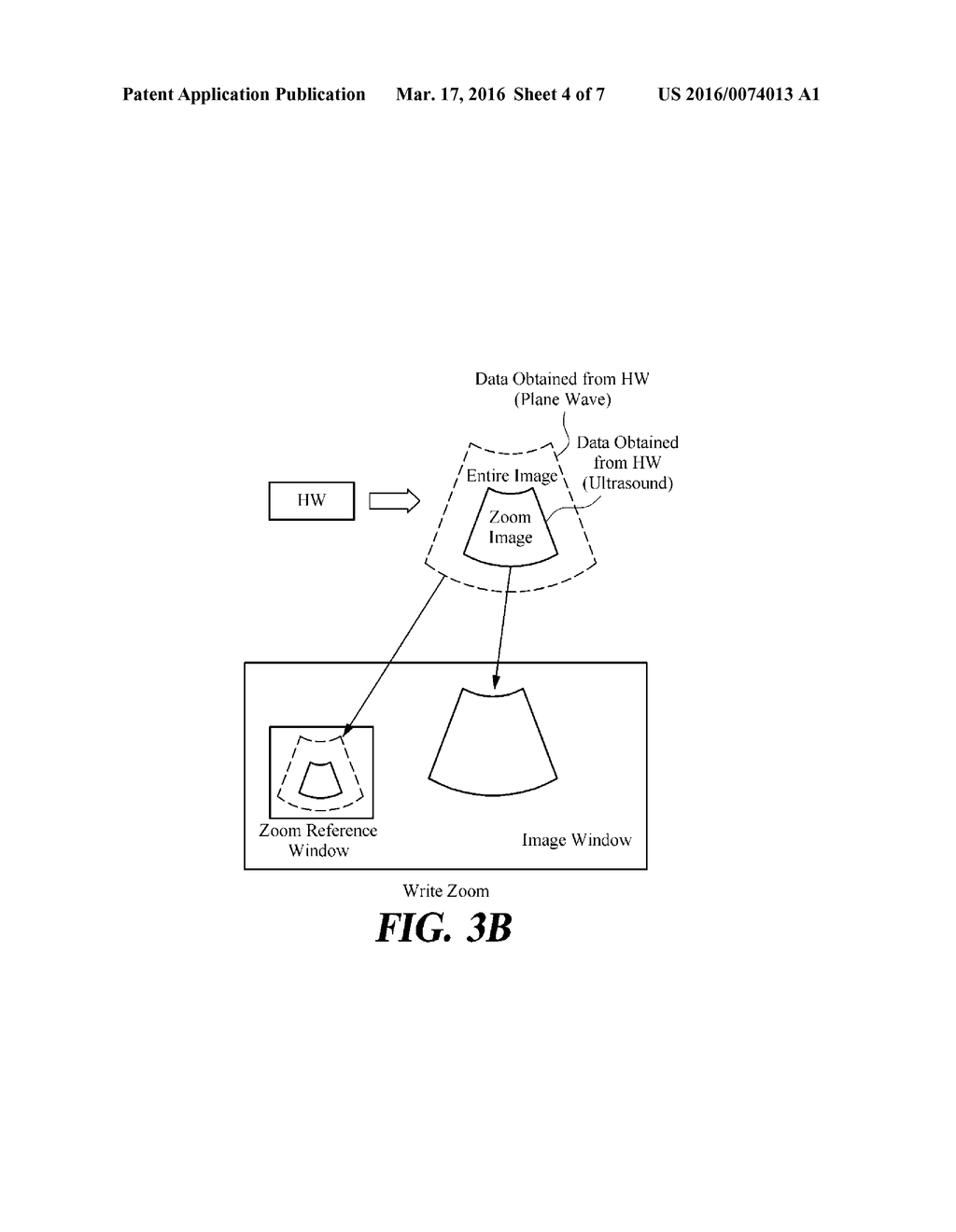 IMAGE ENLARGEMENT METHOD AND ULTRASOUND MEDICAL DEVICE FOR SAME - diagram, schematic, and image 05