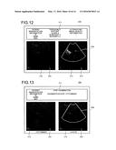 ULTRASONIC OBSERVATION APPARATUS, METHOD FOR OPERATING ULTRASONIC     OBSERVATION APPARATUS, AND COMPUTER READABLE RECORDING MEDIUM diagram and image