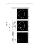 ULTRASONIC OBSERVATION APPARATUS, METHOD FOR OPERATING ULTRASONIC     OBSERVATION APPARATUS, AND COMPUTER READABLE RECORDING MEDIUM diagram and image