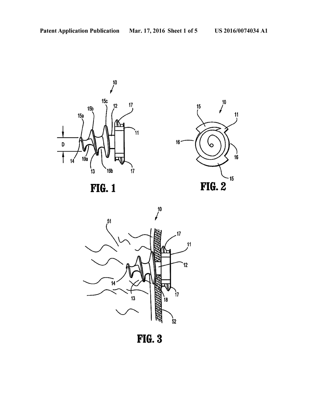 ABSORBABLE FASTENER FOR HERNIA MESH FIXATION - diagram, schematic, and image 02