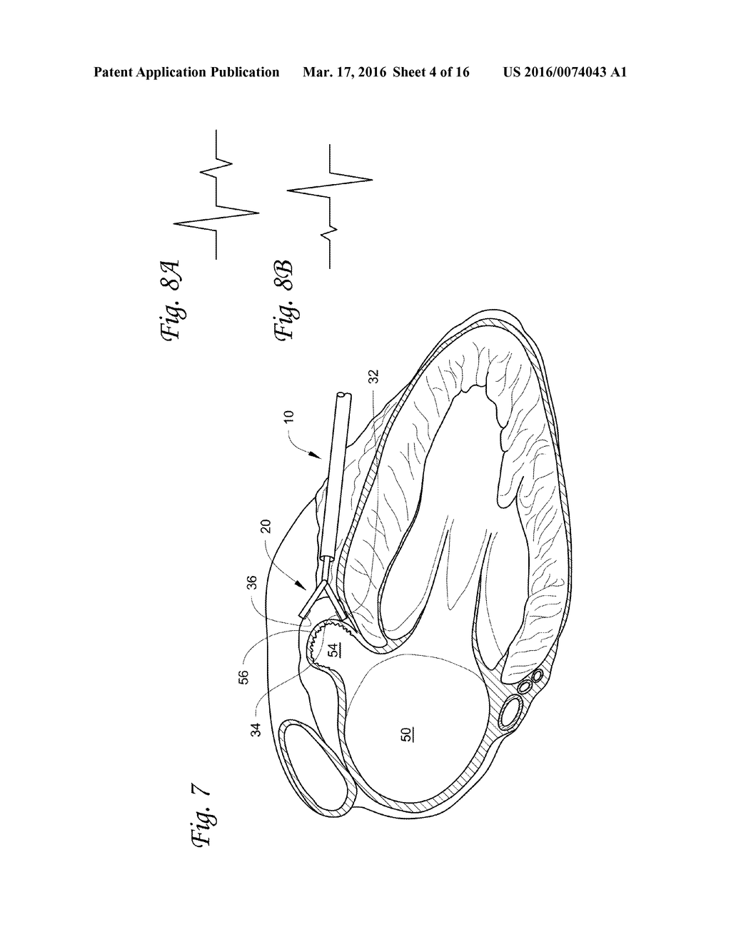 TISSUE CAPTURE AND OCCLUSION SYSTEMS AND METHODS - diagram, schematic, and image 05