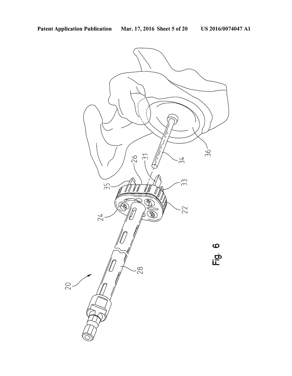 Interchangeable Drill Bits for Drill Assembly - diagram, schematic, and image 06