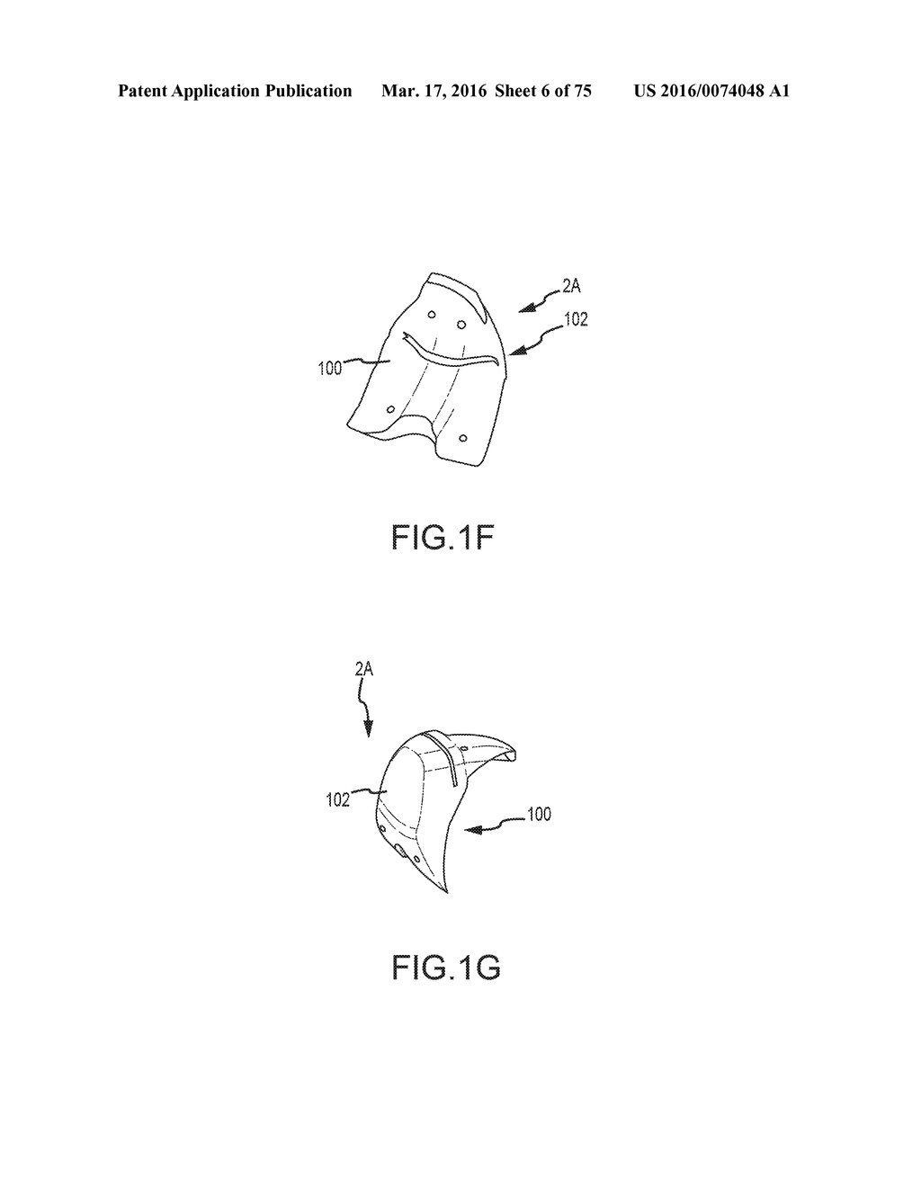 SYSTEM AND METHOD FOR IMAGE SEGMENTATION IN GENERATING COMPUTER MODELS OF     A JOINT TO UNDERGO ARTHROPLASTY - diagram, schematic, and image 07