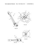 IRIS RETRACTOR FORCEPS diagram and image