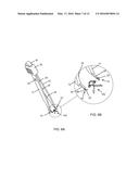 IRIS RETRACTOR FORCEPS diagram and image