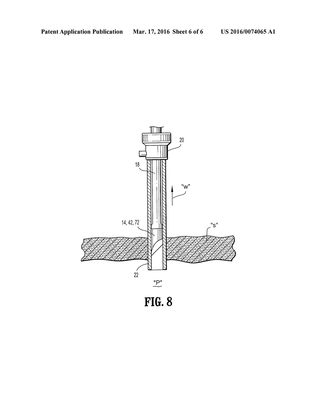 ACCESS SHEATH WITH REMOVABLE OPTICAL PENETRATING MEMBER - diagram, schematic, and image 07