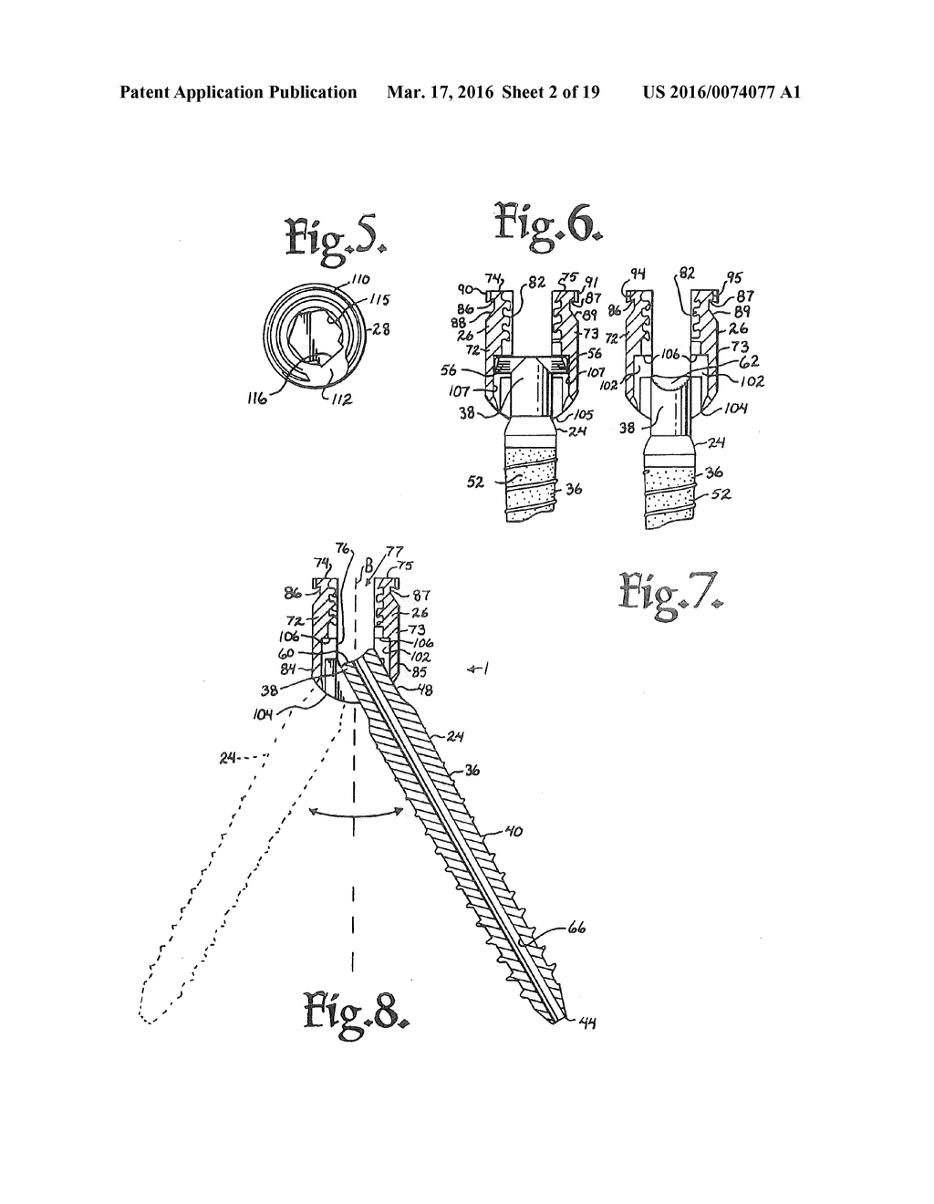 DYNAMIC SPINAL STABILIZATION ASSEMBLIES, TOOL SET AND METHOD - diagram, schematic, and image 03