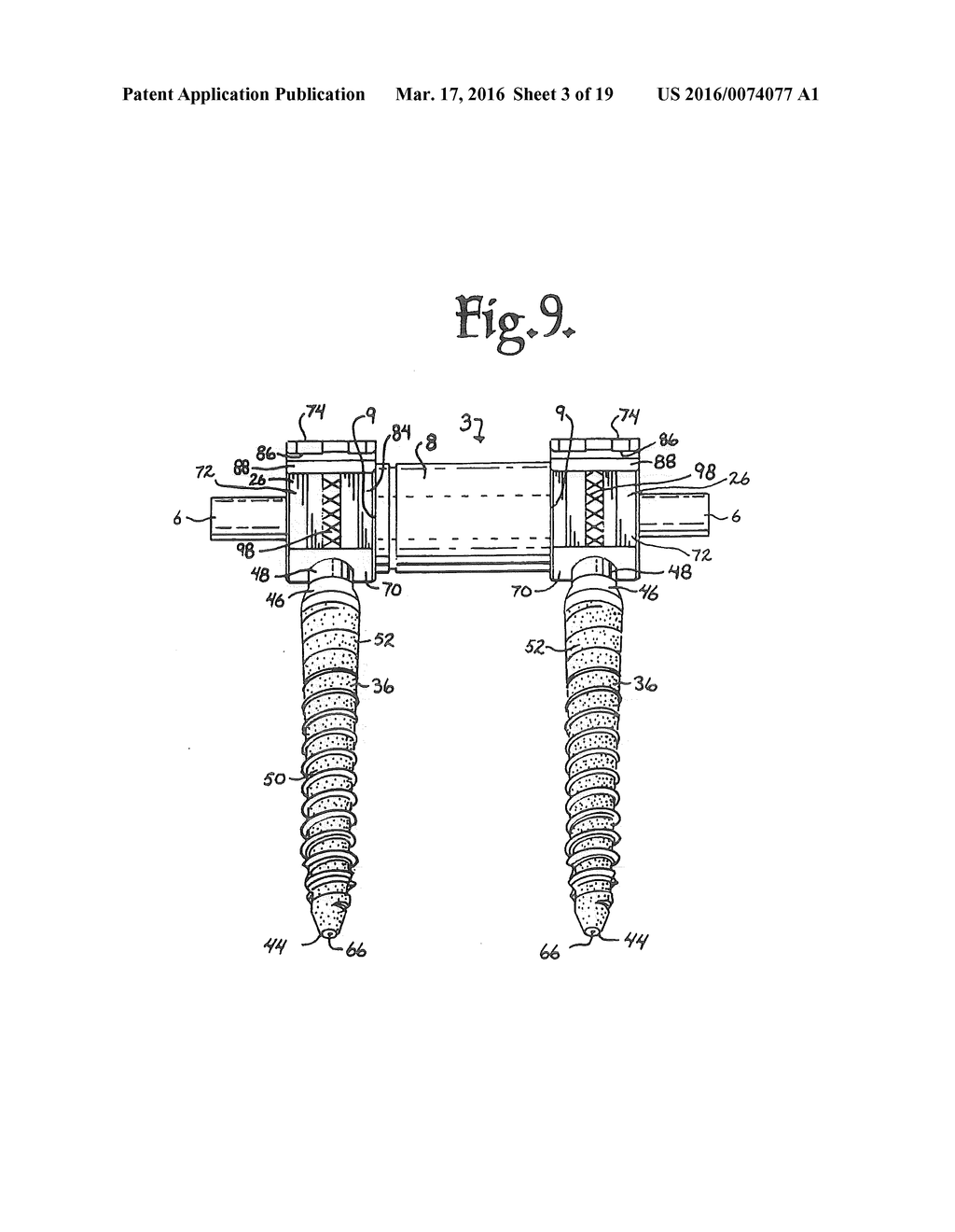 DYNAMIC SPINAL STABILIZATION ASSEMBLIES, TOOL SET AND METHOD - diagram, schematic, and image 04