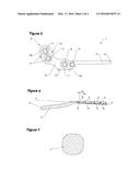 OSTEOTOMY DEVICE, IN PARTICULAR FOR PERFORMING EXTREME SCARF OSTEOTOMY IN     THE TREATMENT OF SEVERE HALLUX VALGUS diagram and image