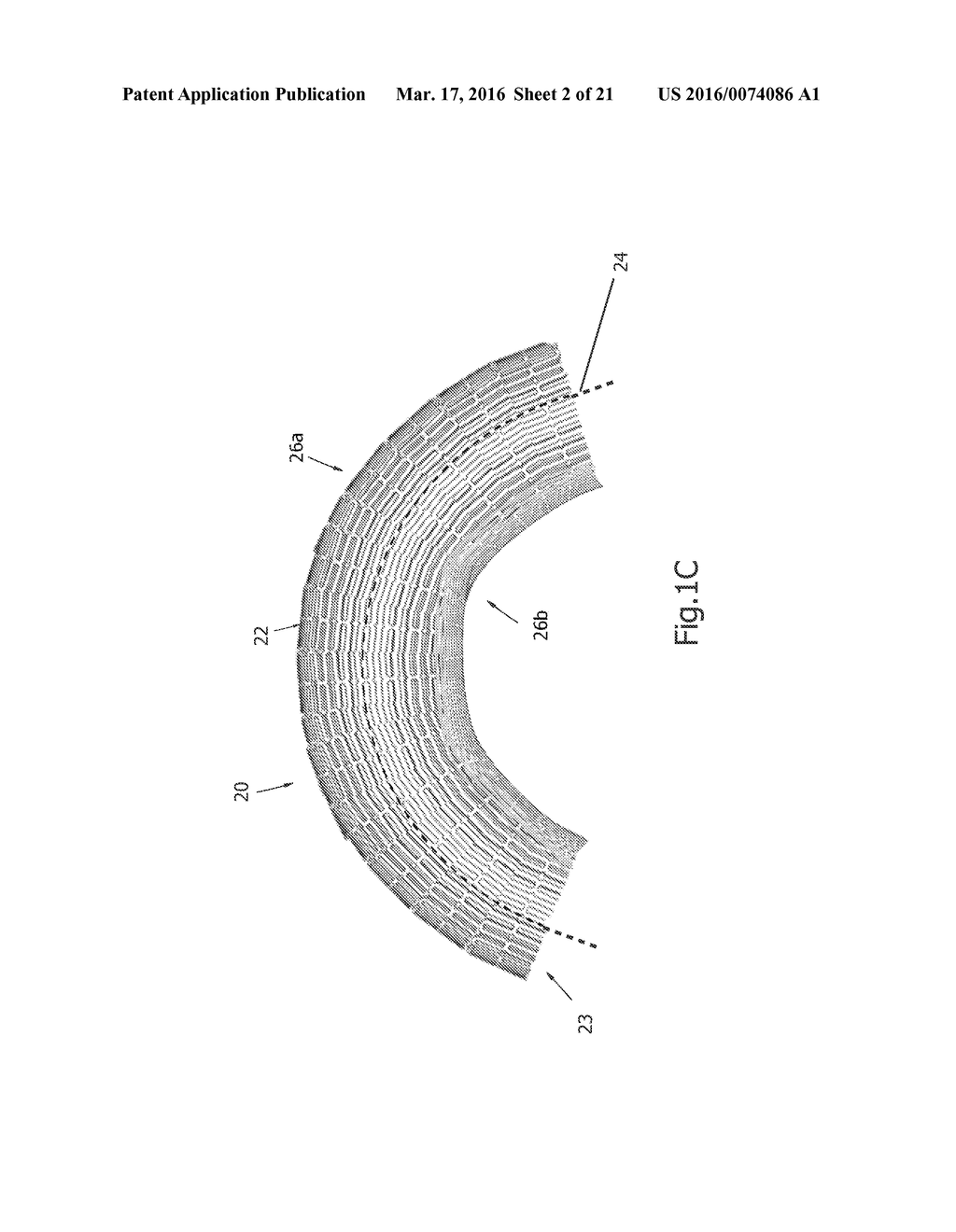 Expandable Bone Implant - diagram, schematic, and image 03