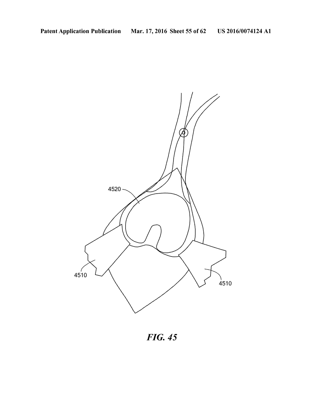 Patient Selectable Joint Arthroplasty Devices and Surgical Tools - diagram, schematic, and image 56