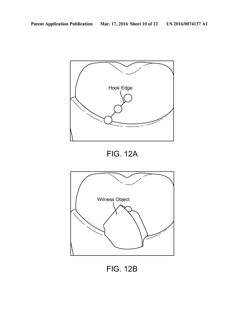 REINFORCED ALIGNER HOOKS - diagram, schematic, and image 11