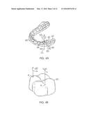 SYSTEM AND METHOD FOR DETECTING DEVIATIONS DURING THE COURSE OF AN     ORTHODONTIC TREATMENT TO GRADUALLY REPOSITION TEETH diagram and image