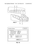 SYSTEM AND METHOD FOR DETECTING DEVIATIONS DURING THE COURSE OF AN     ORTHODONTIC TREATMENT TO GRADUALLY REPOSITION TEETH diagram and image