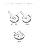 INFLATABLE PROSTHESES AND METHODS OF MAKING SAME diagram and image