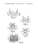 CASSETTE FOR RECEIVING AN INTRAOCULAR LENS, INJECTOR DEVICE HAVING SAID     CASSETTE AND METHOD FOR FOLDING AN INTRAOCULAR LENS IN A CASSETTE diagram and image