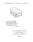 INTERVERTEBRAL DISC diagram and image