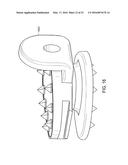 INTERVERTEBRAL DISC diagram and image