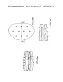 INTERVERTEBRAL DISC diagram and image