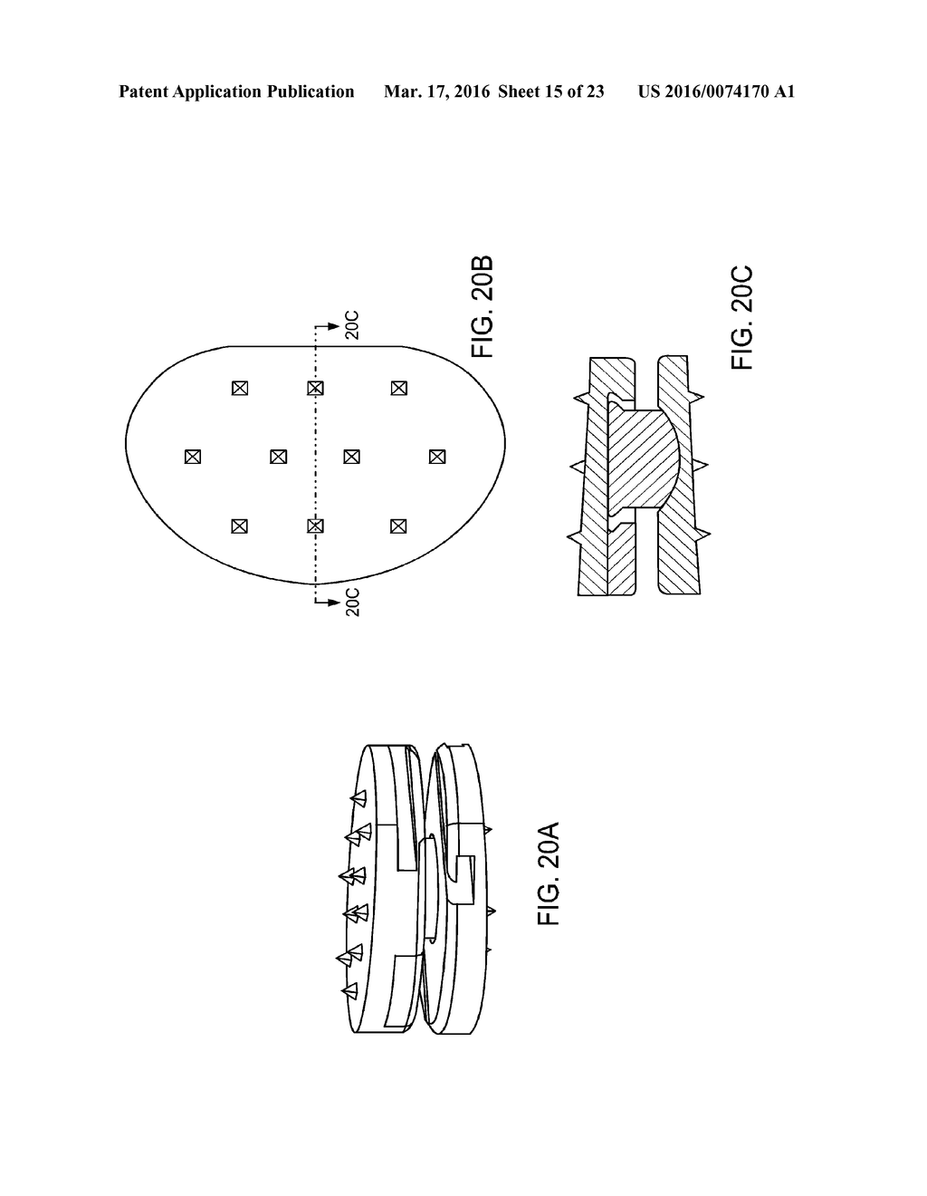 INTERVERTEBRAL DISC - diagram, schematic, and image 16