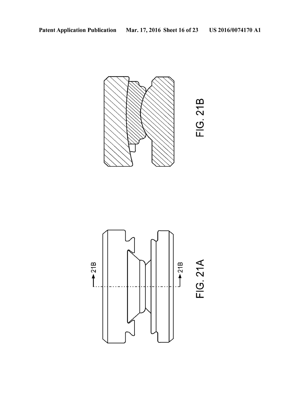 INTERVERTEBRAL DISC - diagram, schematic, and image 17