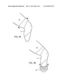 METHODS FOR PREPARING PRECISELY FITTED CASTS for PROSTHETICS diagram and image