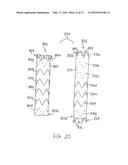 LOW PROFILE NON-SYMMETRICAL STENT diagram and image