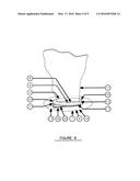 Ostomy appliance removable washable reusable non-adhesive sealing member diagram and image