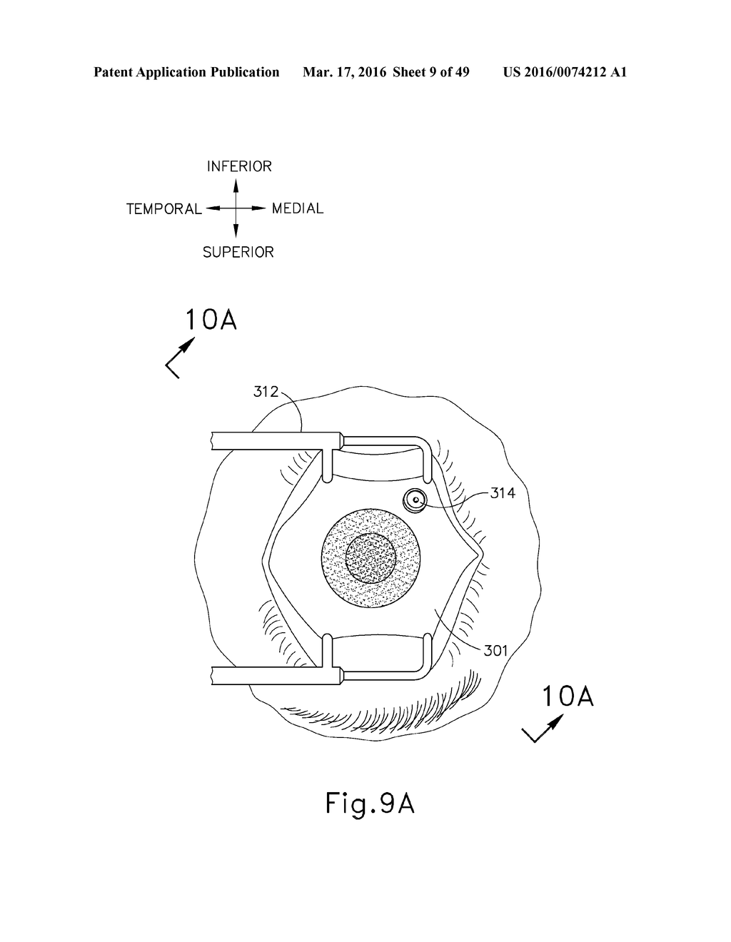 METHOD AND APPARATUS FOR SENSING POSITION BETWEEN LAYERS OF AN EYE - diagram, schematic, and image 10