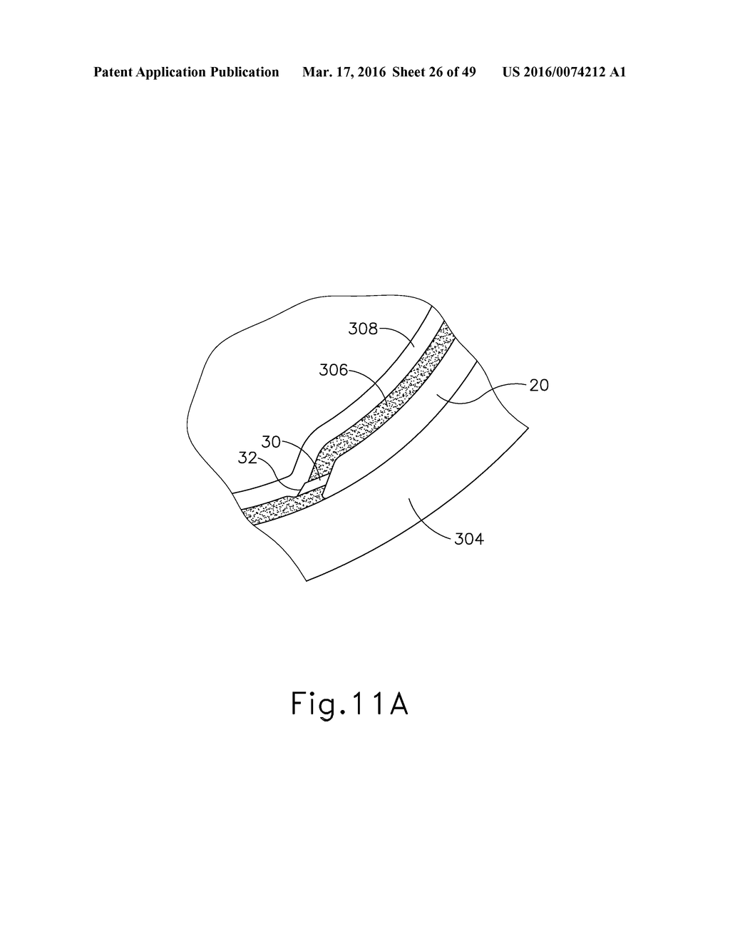 METHOD AND APPARATUS FOR SENSING POSITION BETWEEN LAYERS OF AN EYE - diagram, schematic, and image 27